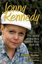 Watch The Boy Whose Skin Fell Off 123movies