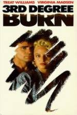Watch Third Degree Burn 123movies