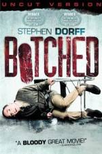 Watch Botched 123movies