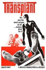 Watch The Amazing Transplant 123movies