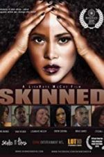 Watch Skinned 123movies