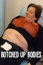 Watch Botched Up Bodies 123movies