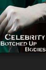 Watch Celebrity Botched Up Bodies 123movies